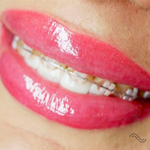 abnikka-nano-lips-permanent-makeup-ecuri2